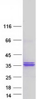 RPIA / RPI Protein - Purified recombinant protein RPIA was analyzed by SDS-PAGE gel and Coomassie Blue Staining