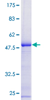 RPL10 / Ribosomal Protein L10 Protein - 12.5% SDS-PAGE of human RPL10 stained with Coomassie Blue