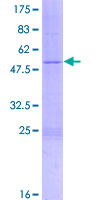 RPL10 / Ribosomal Protein L10 Protein - 12.5% SDS-PAGE of human RPL10 stained with Coomassie Blue