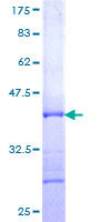 RPL10 / Ribosomal Protein L10 Protein - 12.5% SDS-PAGE Stained with Coomassie Blue.
