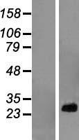 RPL10A Protein - Western validation with an anti-DDK antibody * L: Control HEK293 lysate R: Over-expression lysate
