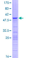 RPL10A Protein - 12.5% SDS-PAGE of human RPL10A stained with Coomassie Blue