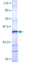 RPL10A Protein - 12.5% SDS-PAGE Stained with Coomassie Blue.