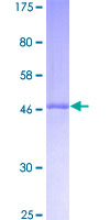 RPL10L Protein - 12.5% SDS-PAGE of human RPL10L stained with Coomassie Blue