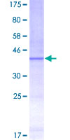 RPL11 / Ribosomal Protein L11 Protein - 12.5% SDS-PAGE Stained with Coomassie Blue.