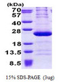 RPL11 / Ribosomal Protein L11 Protein