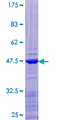 RPL12 / Ribosomal Protein L12 Protein - 12.5% SDS-PAGE of human RPL12 stained with Coomassie Blue