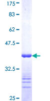 RPL12 / Ribosomal Protein L12 Protein - 12.5% SDS-PAGE Stained with Coomassie Blue.