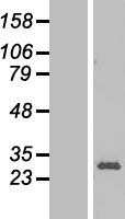 RPL13 / Ribosomal Protein L13 Protein - Western validation with an anti-DDK antibody * L: Control HEK293 lysate R: Over-expression lysate
