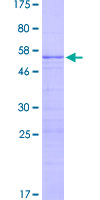 RPL13 / Ribosomal Protein L13 Protein - 12.5% SDS-PAGE of human RPL13 stained with Coomassie Blue