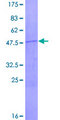 RPL13A Protein - 12.5% SDS-PAGE of human RPL13A stained with Coomassie Blue