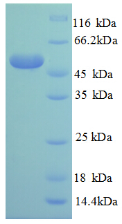 RPL14 / Ribosomal Protein L14 Protein