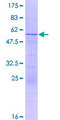 RPL14 / Ribosomal Protein L14 Protein - 12.5% SDS-PAGE of human RPL14 stained with Coomassie Blue