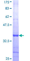 RPL14 / Ribosomal Protein L14 Protein - 12.5% SDS-PAGE Stained with Coomassie Blue.