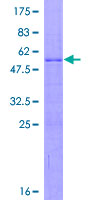 RPL15 / Ribosomal Protein L15 Protein - 12.5% SDS-PAGE of human RPL15 stained with Coomassie Blue