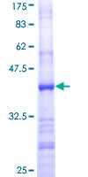 RPL15 / Ribosomal Protein L15 Protein - 12.5% SDS-PAGE Stained with Coomassie Blue.