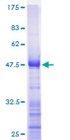 RPL17 / Ribosomal Protein L17 Protein - 12.5% SDS-PAGE of human RPL17 stained with Coomassie Blue