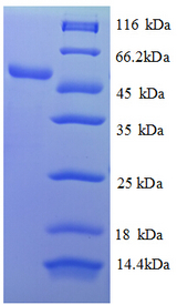 RPL18 / Ribosomal Protein L18 Protein