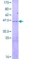 RPL18 / Ribosomal Protein L18 Protein - 12.5% SDS-PAGE of human RPL18 stained with Coomassie Blue