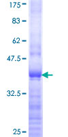 RPL18 / Ribosomal Protein L18 Protein - 12.5% SDS-PAGE Stained with Coomassie Blue.