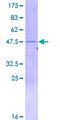 RPL18A Protein - 12.5% SDS-PAGE of human RPL18A stained with Coomassie Blue