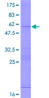 RPL19 / Ribosomal Protein L19 Protein - 12.5% SDS-PAGE of human RPL19 stained with Coomassie Blue