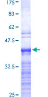 RPL19 / Ribosomal Protein L19 Protein - 12.5% SDS-PAGE Stained with Coomassie Blue.