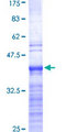 RPL19 / Ribosomal Protein L19 Protein - 12.5% SDS-PAGE Stained with Coomassie Blue.