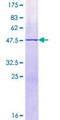 RPL21 / Ribosomal Protein L21 Protein - 12.5% SDS-PAGE of human RPL21 stained with Coomassie Blue