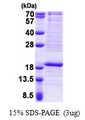 RPL22 / Ribosomal Protein L22 Protein