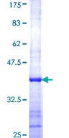 RPL23 / Ribosomal Protein L23 Protein - 12.5% SDS-PAGE Stained with Coomassie Blue.