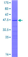 RPL23A Protein - 12.5% SDS-PAGE of human RPL23A stained with Coomassie Blue