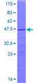 RPL23A Protein - 12.5% SDS-PAGE of human RPL23A stained with Coomassie Blue