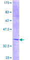 RPL23A Protein - 12.5% SDS-PAGE Stained with Coomassie Blue.