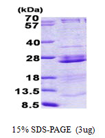 RPL23A Protein