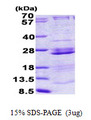 RPL23A Protein