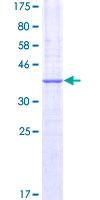RPL26 / Ribosomal Protein L26 Protein - 12.5% SDS-PAGE Stained with Coomassie Blue.