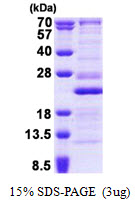 RPL26 / Ribosomal Protein L26 Protein