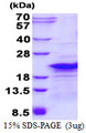 RPL26L1 Protein