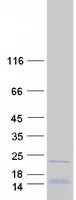 RPL26L1 Protein - Purified recombinant protein RPL26L1 was analyzed by SDS-PAGE gel and Coomassie Blue Staining
