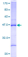 RPL27A Protein - 12.5% SDS-PAGE of human RPL27A stained with Coomassie Blue