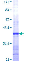 RPL27A Protein - 12.5% SDS-PAGE Stained with Coomassie Blue.