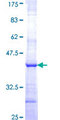 RPL28 / Ribosomal Protein L28 Protein - 12.5% SDS-PAGE Stained with Coomassie Blue.