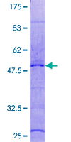 RPL29 / Ribosomal Protein L29 Protein - 12.5% SDS-PAGE of human RPL29 stained with Coomassie Blue
