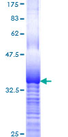 RPL29 / Ribosomal Protein L29 Protein - 12.5% SDS-PAGE Stained with Coomassie Blue.