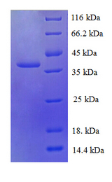 RPL30 / Ribosomal Protein L30 Protein