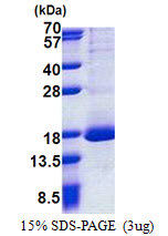 RPL30 / Ribosomal Protein L30 Protein