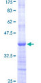 RPL31 / Ribosomal Protein L31 Protein - 12.5% SDS-PAGE Stained with Coomassie Blue.