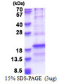 RPL31 / Ribosomal Protein L31 Protein