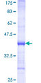 RPL32 / Ribosomal Protein L32 Protein - 12.5% SDS-PAGE Stained with Coomassie Blue.